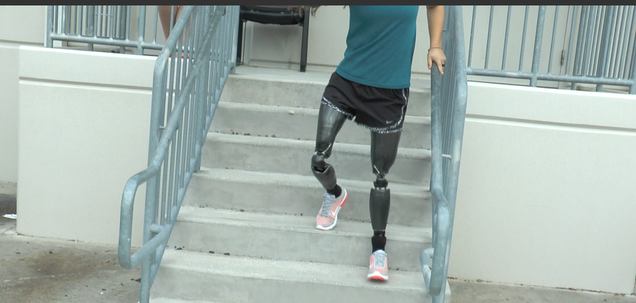 TaiLor Made Foot Enables Ryanne to Walk Down Stairs with Control!